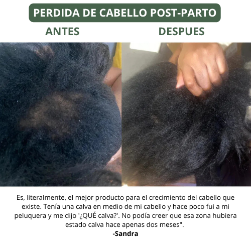 Aceite de Batana para el Crecimiento Natural del Cabello