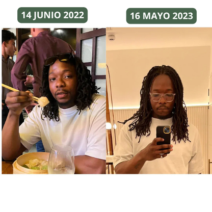 Aceite de Batana para el Crecimiento Natural del Cabello