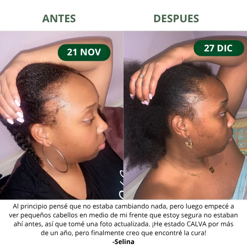 Aceite de Batana para el Crecimiento Natural del Cabello