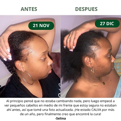 Aceite de Batana para el Crecimiento Natural del Cabello